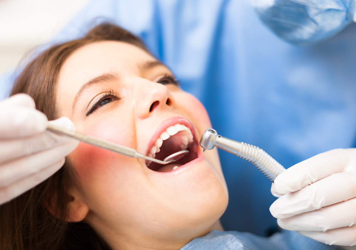 What Are Composite Dental Fillings, and Why Do You Need Them? : Santa  Monica Bay Dental: Dentists